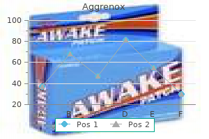 aggrenox caps 25/200mg low cost