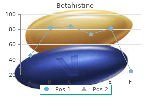 betahistine 16mg buy generic