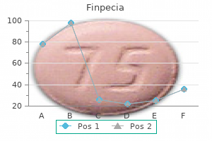 1 mg finpecia generic mastercard