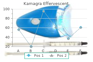 100 mg kamagra effervescent generic with mastercard